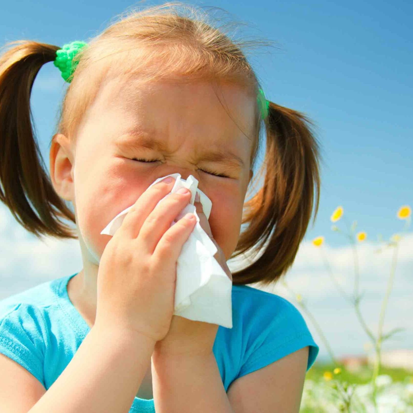 Allergies Allergies